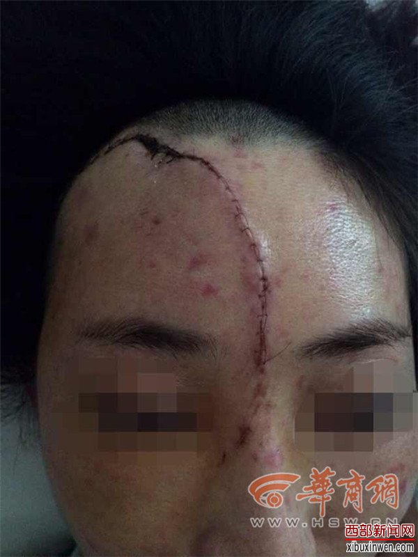 С��ͷ������170���� ���̱���׿ ��